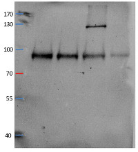 V-ATPase, a1 | vacuolar H+-ATPase subunit a isoform 1 in the group Antibodies for Plant/Algal / Membrane Transport System / Vacuolar membrane at Agrisera AB (Antibodies for research) (AS14 2822)
